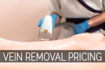 vein treatment services pricing